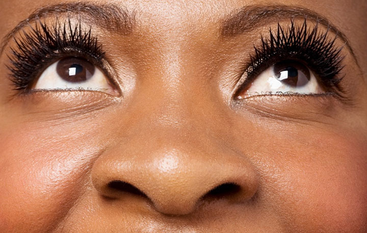 Nariz Negroide: Características, Queixas e Cirurgia (Rinoplastia)